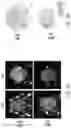 Fig. 35 - INDUCING FAVORABLE EFFECTS ON TUMOR MICROENVIRONMENT VIA ADMINISTRATION OF NANOPARTICLE COMPOSITIONS