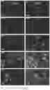 Fig. 79 - INDUCING FAVORABLE EFFECTS ON TUMOR MICROENVIRONMENT VIA ADMINISTRATION OF NANOPARTICLE COMPOSITIONS