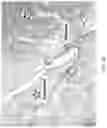 Fig. 31 - Silk-hyaluronic acid based tissue fillers and methods of using the same
