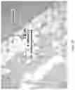 Fig. 32 - Silk-hyaluronic acid based tissue fillers and methods of using the same