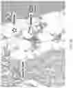 Fig. 33 - Silk-hyaluronic acid based tissue fillers and methods of using the same