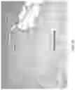Fig. 38 - Silk-hyaluronic acid based tissue fillers and methods of using the same