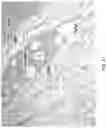 Fig. 42 - Silk-hyaluronic acid based tissue fillers and methods of using the same