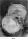 Fig. 15 - HYDROGELS AND METHOD OF MAKING THE SAME