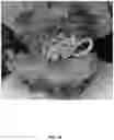 Fig. 16 - HYDROGELS AND METHOD OF MAKING THE SAME