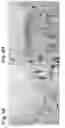 Fig. 05 - Cartilage Regeneration Using Chondrocyte And TGF-Beta