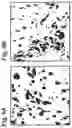 Fig. 10 - Cartilage Regeneration Using Chondrocyte And TGF-Beta