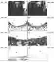 Fig. 12 - Cartilage Regeneration Using Chondrocyte And TGF-Beta