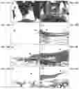 Fig. 13 - Cartilage Regeneration Using Chondrocyte And TGF-Beta