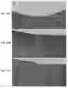 Fig. 14 - Cartilage Regeneration Using Chondrocyte And TGF-Beta