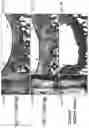 Fig. 16 - Cartilage Regeneration Using Chondrocyte And TGF-Beta