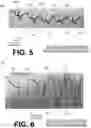 Fig. 06 - RHYTHM SENSING DURING EXTERNAL PACING