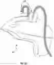 Fig. 12 - SYSTEMS FOR FACILITATING LOW-LEVEL LASER THERAPY ON A HEAD OF A USER