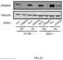 Fig. 12 - METHODS FOR MODULATION OF AND SENSITIZATION TO SERINE AND GLYCINE LIMITATION