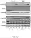 Fig. 35 - METHODS FOR MODULATION OF AND SENSITIZATION TO SERINE AND GLYCINE LIMITATION