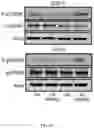 Fig. 42 - METHODS FOR MODULATION OF AND SENSITIZATION TO SERINE AND GLYCINE LIMITATION