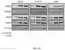 Fig. 43 - METHODS FOR MODULATION OF AND SENSITIZATION TO SERINE AND GLYCINE LIMITATION