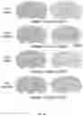 Fig. 46 - METHODS FOR MODULATION OF AND SENSITIZATION TO SERINE AND GLYCINE LIMITATION