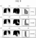 Fig. 06 - Patient position determination system, method, and program