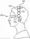 Fig. 01 - Closed-loop non-invasive transcranial stimulation and neural activity recording system and method