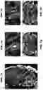 Fig. 10 - Systems and methods for opening of a tissue barrier in primates