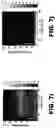 Fig. 11 - Systems and methods for opening of a tissue barrier in primates