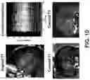Fig. 14 - Systems and methods for opening of a tissue barrier in primates