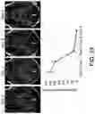 Fig. 17 - Systems and methods for opening of a tissue barrier in primates
