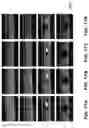 Fig. 21 - Systems and methods for opening of a tissue barrier in primates