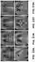 Fig. 31 - Systems and methods for opening of a tissue barrier in primates