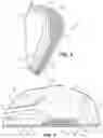 Fig. 05 - Mixed material golf club head
