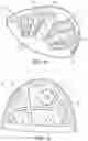 Fig. 09 - Mixed material golf club head
