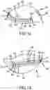 Fig. 07 - Adjustable weight club head