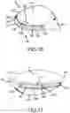 Fig. 08 - Adjustable weight club head