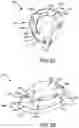 Fig. 13 - Adjustable weight club head