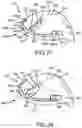 Fig. 22 - Adjustable weight club head
