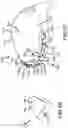Fig. 32 - Adjustable weight club head