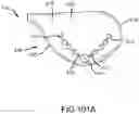 Fig. 51 - Adjustable weight club head