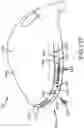 Fig. 68 - Adjustable weight club head