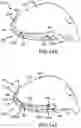 Fig. 71 - Adjustable weight club head