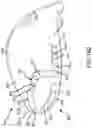 Fig. 72 - Adjustable weight club head