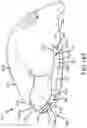 Fig. 73 - Adjustable weight club head