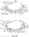 Fig. 80 - Adjustable weight club head