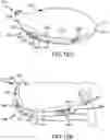 Fig. 81 - Adjustable weight club head