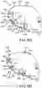 Fig. 86 - Adjustable weight club head