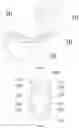 Fig. 02 - Plastic spring, pump core, lotion pump and press-type packaging container