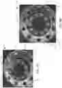Fig. 05 - Systems and methods for identifying and mitigating lug nut loosening