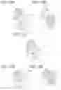 Fig. 11 - Handle device for vehicle