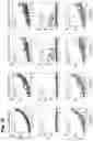 Fig. 77 - Torque vectoring unit