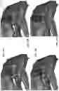 Fig. 25 - Kinematic vehicle seat